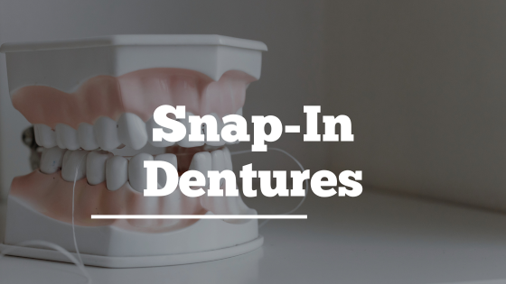 snap-in dentures